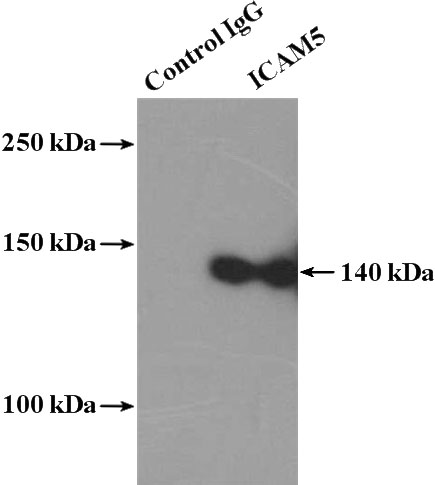 IP Result of anti-ICAM5 (IP:Catalog No:111592, 4ug; Detection:Catalog No:111592 1:300) with mouse brain tissue lysate 4000ug.