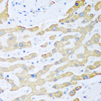 Immunohistochemistry - FDXR Polyclonal Antibody 