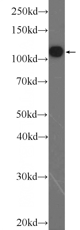 HEK-293 cells were subjected to SDS PAGE followed by western blot with Catalog No:116448(TXNDC16 Antibody) at dilution of 1:600
