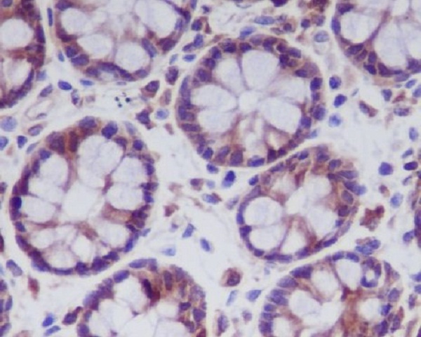 Immunohistochemical analysis of paraffin-embedded human colon, using MLKL Antibody.