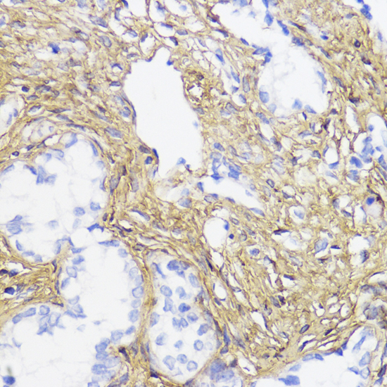 Immunohistochemistry - COL1A1 Polyclonal Antibody 