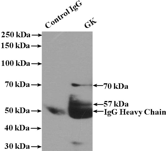 IP Result of anti-GK (IP:Catalog No:111084, 4ug; Detection:Catalog No:111084 1:1000) with HepG2 cells lysate 4000ug.