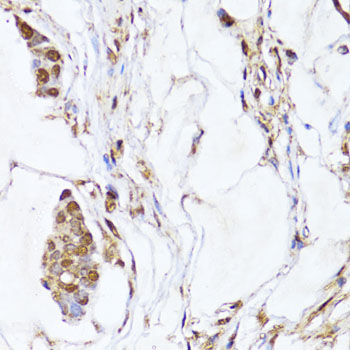 Immunohistochemistry - EGLN1/EGLN2 Polyclonal Antibody 