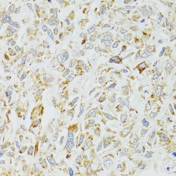 Immunohistochemistry - DICER1 Polyclonal Antibody 