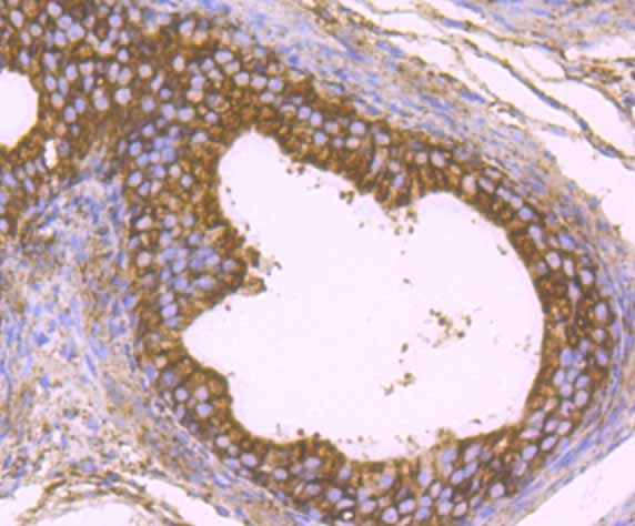 Fig8:; Immunohistochemical analysis of paraffin-embedded rat epididymis tissue using anti-KDEL antibody. The section was pre-treated using heat mediated antigen retrieval with Tris-EDTA buffer (pH 8.0-8.4) for 20 minutes.The tissues were blocked in 5% BSA for 30 minutes at room temperature, washed with ddH; 2; O and PBS, and then probed with the primary antibody ( 1/400) for 30 minutes at room temperature. The detection was performed using an HRP conjugated compact polymer system. DAB was used as the chromogen. Tissues were counterstained with hematoxylin and mounted with DPX.