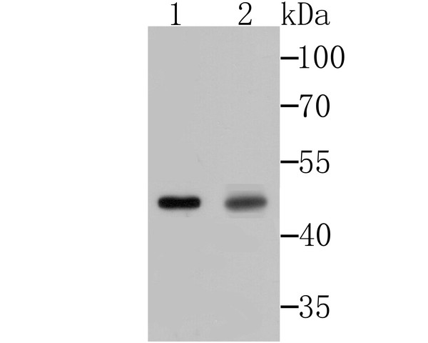 Fig1:; Western blot analysis of Galectin 8 on different lysates. Proteins were transferred to a PVDF membrane and blocked with 5% BSA in PBS for 1 hour at room temperature. The primary antibody ( 1/500) was used in 5% BSA at room temperature for 2 hours. Goat Anti-Rabbit IgG - HRP Secondary Antibody (HA1001) at 1:200,000 dilution was used for 1 hour at room temperature.; Positive control:; Lane 1: Mouse testis tissue lysate; Lane 2: Rat testis tissue lysate