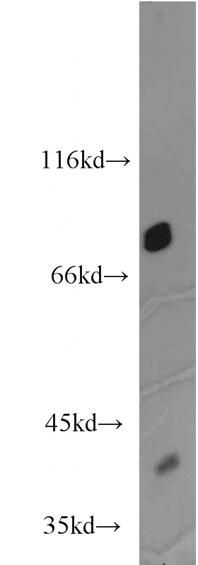 HeLa cells were subjected to SDS PAGE followed by western blot with Catalog No:117274(ZYX antibody) at dilution of 1:1000