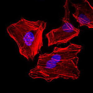 Immunofluorescence analysis of HeLa cells. Blue