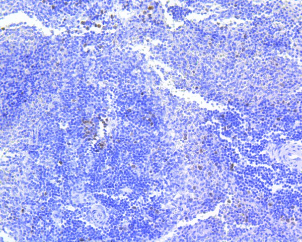 Fig2:; Immunohistochemical analysis of paraffin-embedded rat spleen tissue using anti-Survivin antibody. The section was pre-treated using heat mediated antigen retrieval with Tris-EDTA buffer (pH 8.0-8.4) for 20 minutes.The tissues were blocked in 5% BSA for 30 minutes at room temperature, washed with ddH; 2; O and PBS, and then probed with the primary antibody ( 1/50) for 30 minutes at room temperature. The detection was performed using an HRP conjugated compact polymer system. DAB was used as the chromogen. Tissues were counterstained with hematoxylin and mounted with DPX.