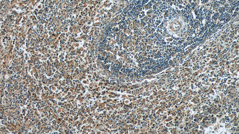 Immunohistochemistry of paraffin-embedded human spleen tissue slide using Catalog No:110367(ERMP1 Antibody) at dilution of 1:50 (under 10x lens)
