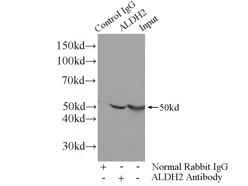 IP Result of anti-ALDH2 (IP:Catalog No:107966, 4ug; Detection:Catalog No:107966 1:1000) with mouse lung tissue lysate 2800ug.
