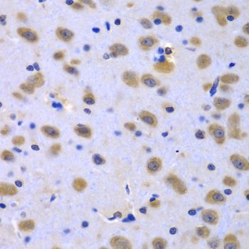 Immunohistochemistry - CIAO1 Polyclonal Antibody 