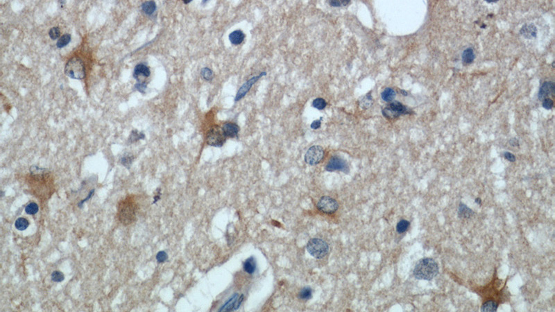 Immunohistochemical of paraffin-embedded human brain using Catalog No:116746(SLC17A7 antibody) at dilution of 1:50 (under 40x lens)