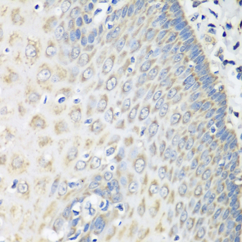 Immunohistochemistry - OXCT1 Polyclonal Antibody 