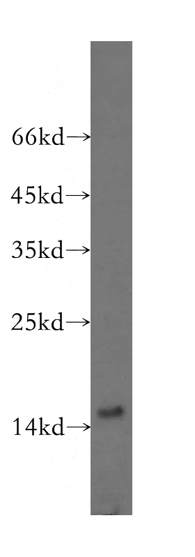 human brain tissue were subjected to SDS PAGE followed by western blot with Catalog No:112843(MRPS16 antibody) at dilution of 1:400