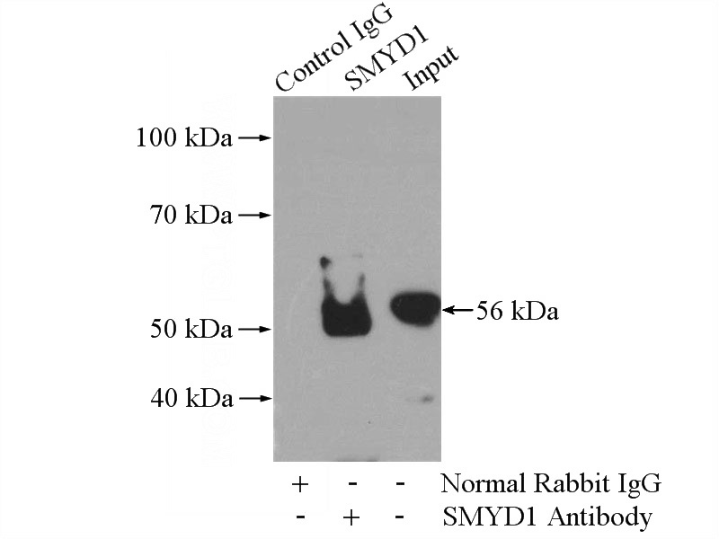 IP Result of anti-SMYD1-Specific (IP:Catalog No:115406, 4ug; Detection:Catalog No:115406 1:500) with mouse heart tissue lysate 4000ug.