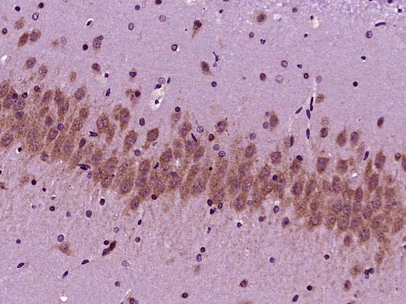 Fig3: Paraformaldehyde-fixed, paraffin embedded (Rat brain); Antigen retrieval by boiling in sodium citrate buffer (pH6.0) for 15min; Block endogenous peroxidase by 3% hydrogen peroxide for 20 minutes; Blocking buffer (normal goat serum) at 37℃ for 30min; Antibody incubation with (SCFD2) Polyclonal Antibody, Unconjugated at 1:400 overnight at 4℃, followed by operating according to SP Kit(Rabbit) (sp-0023) instructionsand DAB staining.