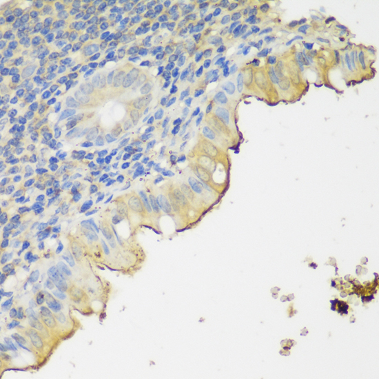 Immunohistochemistry - CLN5 Polyclonal Antibody 