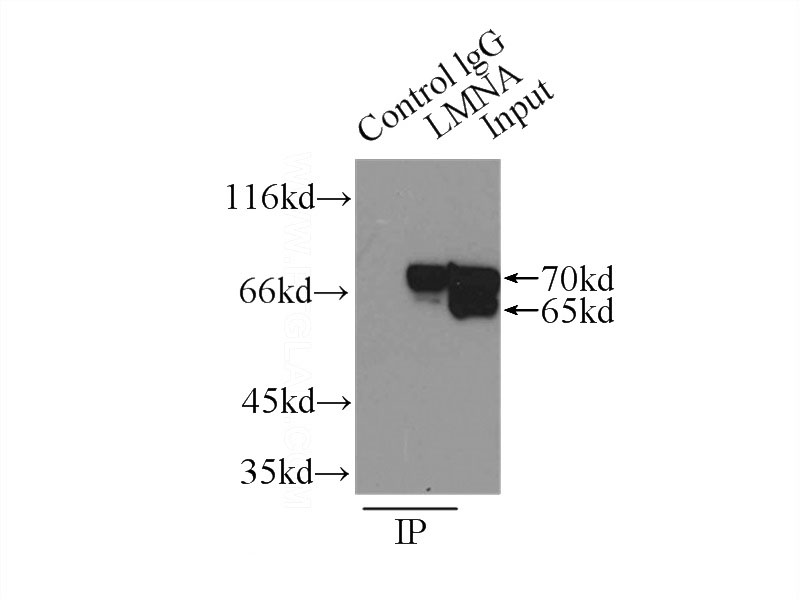 IP Result of anti-lamin-A (IP:Catalog No:117327, 3ug; Detection:Catalog No:117327 1:1000) with A375 cells lysate 800ug.