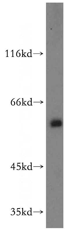HeLa cells were subjected to SDS PAGE followed by western blot with Catalog No:116114(THUMPD3 antibody) at dilution of 1:2000
