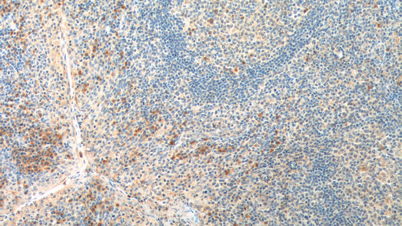 Immunohistochemistry of paraffin-embedded human tonsillitis tissue slide using Catalog No:111708(HTR1A Antibody) at dilution of 1:200 (under 10x lens). heat mediated antigen retrieved with Tris-EDTA buffer(pH9).