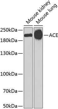 Western blot - ACE Polyclonal Antibody 