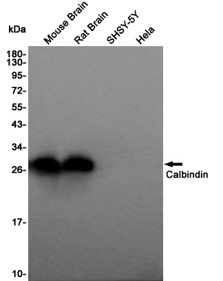 Western blot detection of Calbindin in Mouse Brain,Rat Brain,SHSY-5Y,Hela cell lysates using Calbindin Rabbit pAb(1:1000 diluted).Predicted band size:30KDa.Observed band size:30KDa.