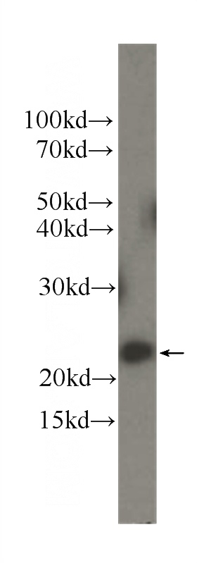 HeLa cells were subjected to SDS PAGE followed by western blot with Catalog No:107484(Pre-IL18 Antibody) at dilution of 1:1000