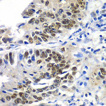 Immunohistochemistry - DACH1 Polyclonal Antibody 