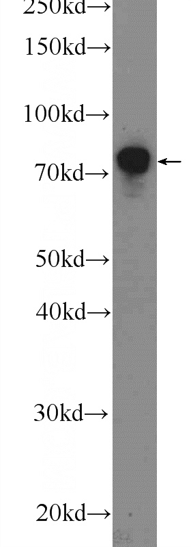 mouse lung tissue were subjected to SDS PAGE followed by western blot with Catalog No:115889(TBX2 Antibody) at dilution of 1:300