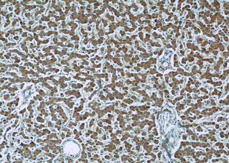 Immunohistochemistry of paraffin-embedded human liver slide using Catalog No:113050(ND1 Antibody) at dilution of 1:50