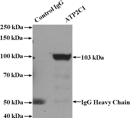 IP Result of anti-ATP2C1 (IP:Catalog No:108348, 4ug; Detection:Catalog No:108348 1:500) with mouse kidney tissue lysate 4000ug.