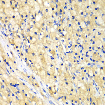 Immunohistochemistry - NUP62 Polyclonal Antibody 
