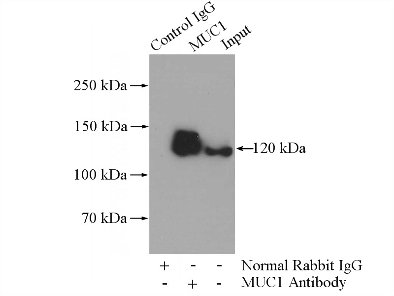 IP Result of anti-CA15-3,MUC1 (IP:Catalog No:112888, 4ug; Detection:Catalog No:112888 1:700) with A431 cells lysate 1520ug.
