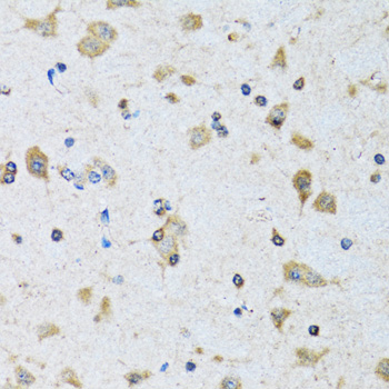 Immunohistochemistry - PDP1 Polyclonal Antibody 