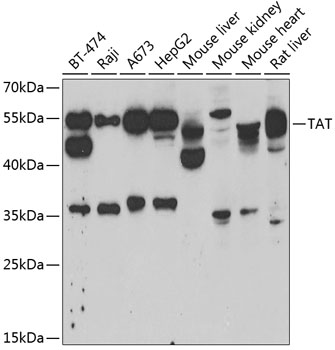 Western blot - TAT Polyclonal Antibody 
