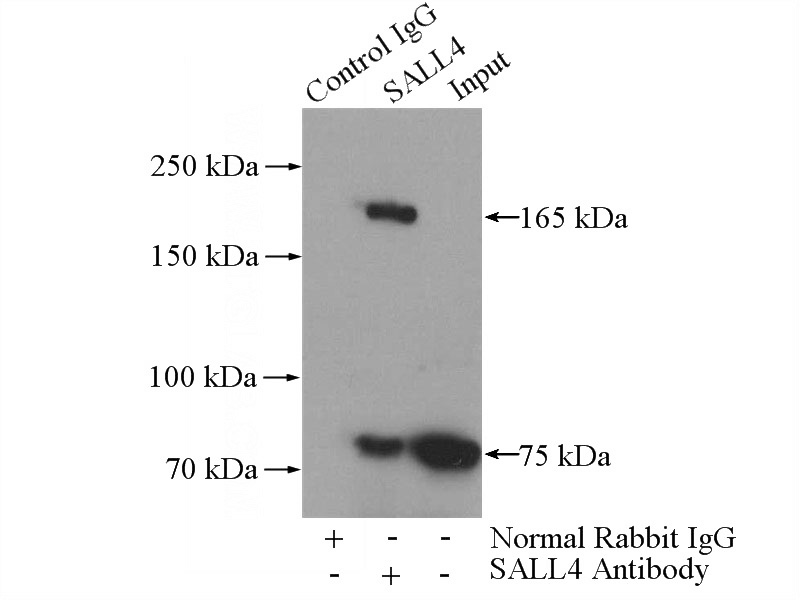 IP Result of anti-SALL4 (IP:Catalog No:115048, 4ug; Detection:Catalog No:115048 1:600) with HepG2 cells lysate 3600ug.
