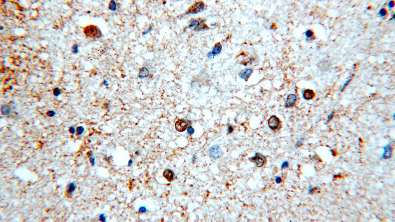 Immunohistochemical of paraffin-embedded human brain using Catalog No:113012(NAB2 antibody) at dilution of 1:100 (under 40x lens)