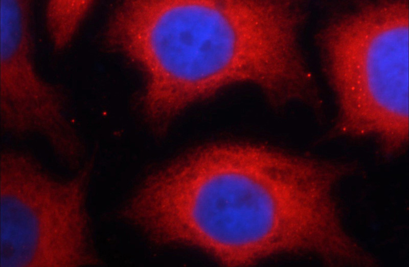 Immunofluorescent analysis of MCF-7 cells using Catalog No:117297(Tubulin-Alpha Antibody) at dilution of 1:25 and Rhodamine-Goat anti-Rabbit IgG