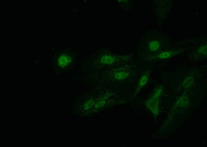 Immunofluorescent analysis of A549 cells using Catalog No:108163(ACTR5 Antibody) at dilution of 1:25 and Alexa Fluor 488-congugated AffiniPure Goat Anti-Rabbit IgG(H+L)