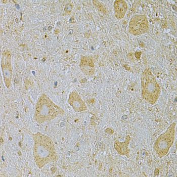 Immunohistochemistry - CAMK1G Polyclonal Antibody 