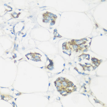 Immunohistochemistry - NMT1 Polyclonal Antibody 