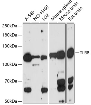 Western blot - TLR8 Polyclonal Antibody 