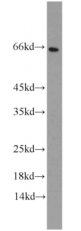 HeLa cells were subjected to SDS PAGE followed by western blot with Catalog No:109164(CDK5RAP3 antibody) at dilution of 1:2000