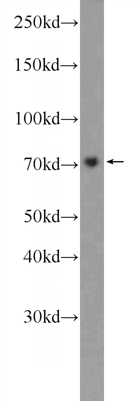 MCF-7 cells were subjected to SDS PAGE followed by western blot with Catalog No:110768(GAB2 Antibody) at dilution of 1:600