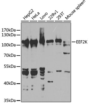 Western blot - EEF2K Polyclonal Antibody 