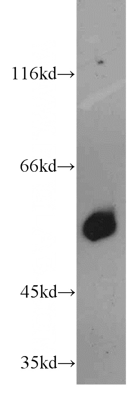 human colon tissue were subjected to SDS PAGE followed by western blot with Catalog No:111463(HRH1 antibody) at dilution of 1:500