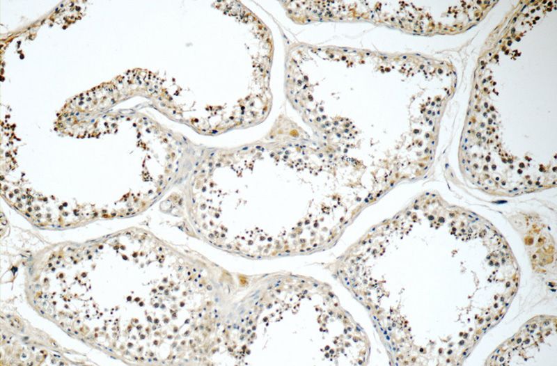 Immunohistochemistry of paraffin-embedded human testis tissue slide using Catalog No:115229(SIK1 Antibody) at dilution of 1:50 (under 10x lens)