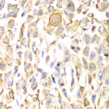 Immunohistochemistry - CD151 Polyclonal Antibody 