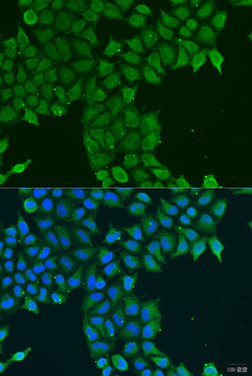 Immunofluorescence - CDK16 Polyclonal Antibody 